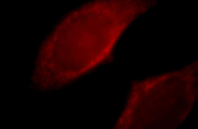 Immunofluorescent analysis of Hela cells, using MYOF antibody Catalog No:112991 at 1:25 dilution and Rhodamine-labeled goat anti-rabbit IgG (red).