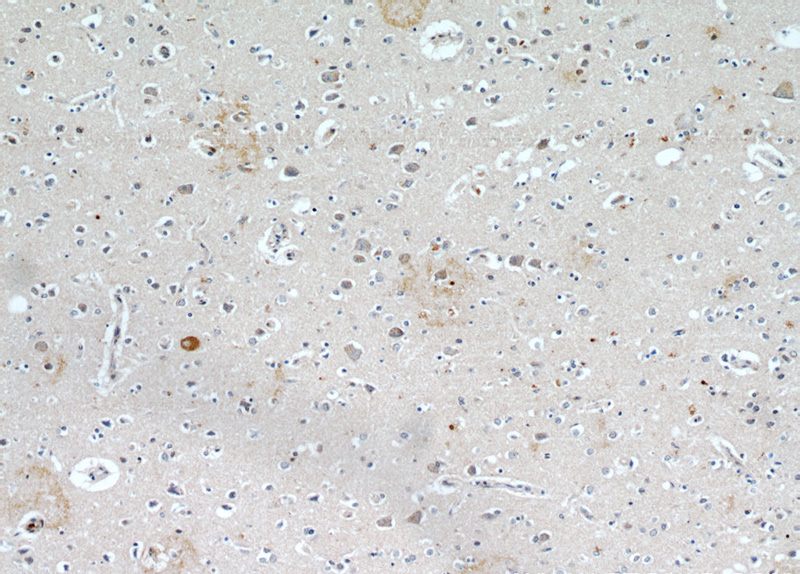 Immunohistochemical of paraffin-embedded human brain using Catalog No:112107(KLHL4 antibody) at dilution of 1:50 (under 10x lens)