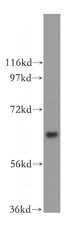 K-562 cells were subjected to SDS PAGE followed by western blot with Catalog No:116005(TFCP2 antibody) at dilution of 1:300