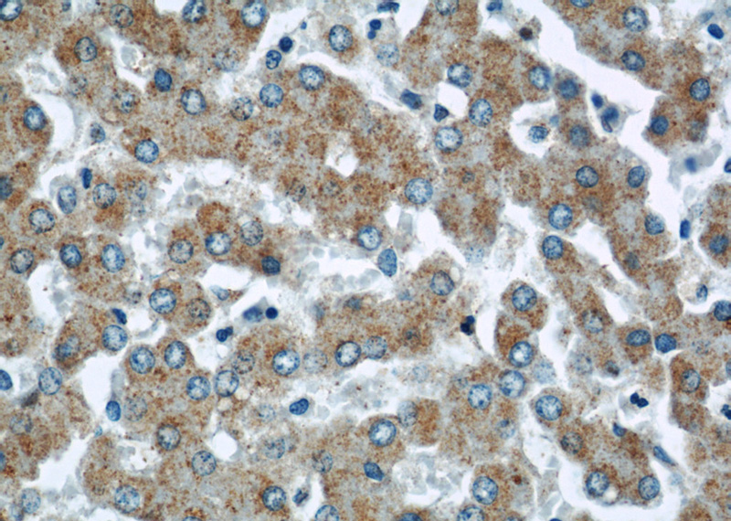 Immunohistochemical of paraffin-embedded human liver using Catalog No:109234(CHMP2B antibody) at dilution of 1:50 (under 40x lens)