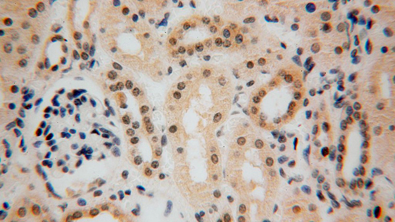 Immunohistochemical of paraffin-embedded human kidney using Catalog No:112148(LARP7 antibody) at dilution of 1:100 (under 40x lens)