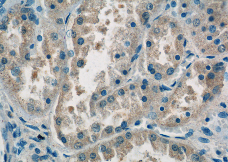 Immunohistochemistry of paraffin-embedded human kidney tissue slide using Catalog No:110057(domain-II-of-FIZ1 Antibody) at dilution of 1:50 (under 40x lens)