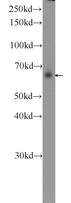 HeLa cells were subjected to SDS PAGE followed by western blot with Catalog No:110235(EMB Antibody) at dilution of 1:1000