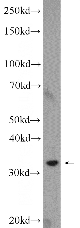 L02 cells were subjected to SDS PAGE followed by western blot with Catalog No:115794(STX17 Antibody) at dilution of 1:1000