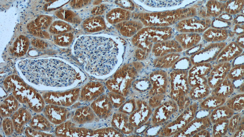 Immunohistochemistry of paraffin-embedded human kidney tissue slide using Catalog No:110081(DNAH17 Antibody) at dilution of 1:50 (under 10x lens)