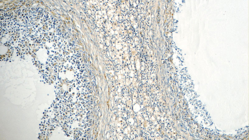 Immunohistochemistry of paraffin-embedded human ovary tissue slide using Catalog No:110182(EIF2B2 Antibody) at dilution of 1:50 (under 10x lens)