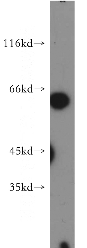 HepG2 cells were subjected to SDS PAGE followed by western blot with Catalog No:113017(NAGS antibody) at dilution of 1:500
