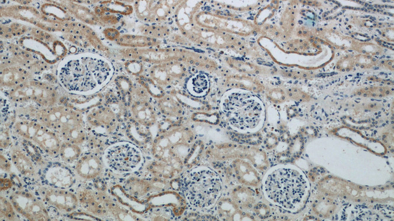 Immunohistochemical of paraffin-embedded human kidney using Catalog No:109687(CYP24A1 antibody) at dilution of 1:50 (under 10x lens)
