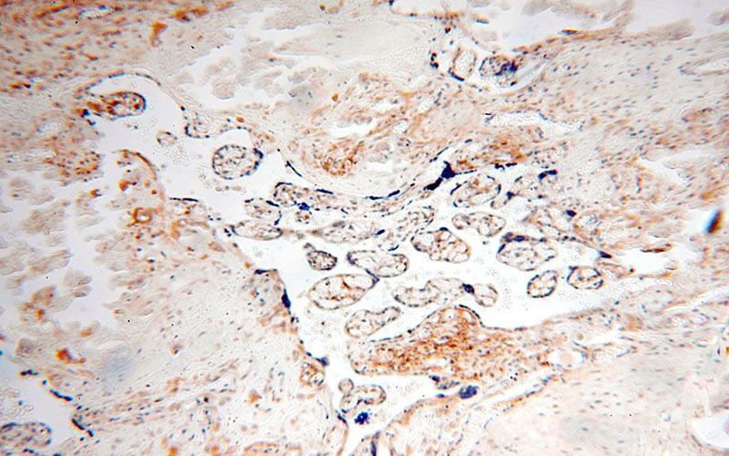 Immunohistochemical of paraffin-embedded human placenta using Catalog No:109812(KRT7-specific antibody) at dilution of 1:100 (under 10x lens)