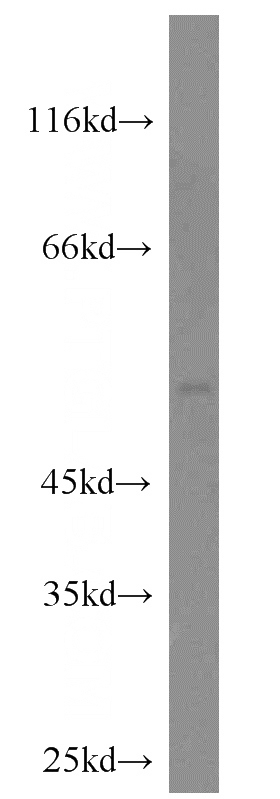 mouse heart tissue were subjected to SDS PAGE followed by western blot with Catalog No:109566(CRLS1 antibody) at dilution of 1:300
