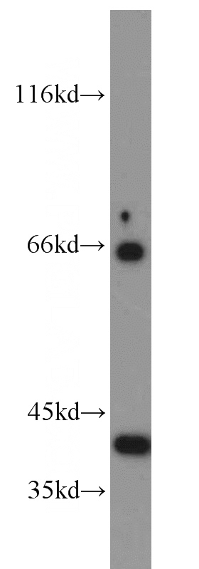 human brain tissue were subjected to SDS PAGE followed by western blot with Catalog No:117190(BLVRA antibody) at dilution of 1:300