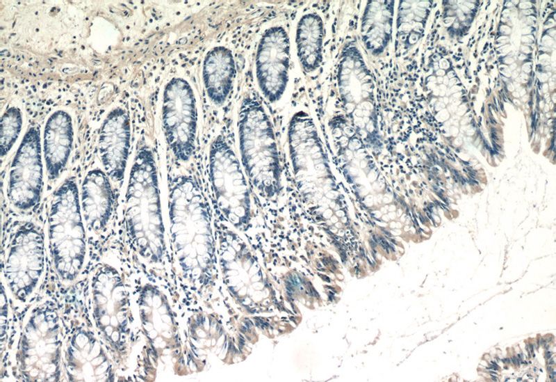 Immunohistochemistry of paraffin-embedded human colon tissue slide using Catalog No:116387(TTC7A Antibody) at dilution of 1:50 (under 10x lens)