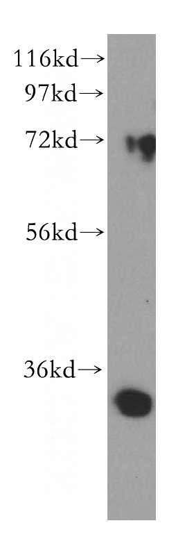 A375 cells were subjected to SDS PAGE followed by western blot with Catalog No:109924(DHRS3 antibody) at dilution of 1:500