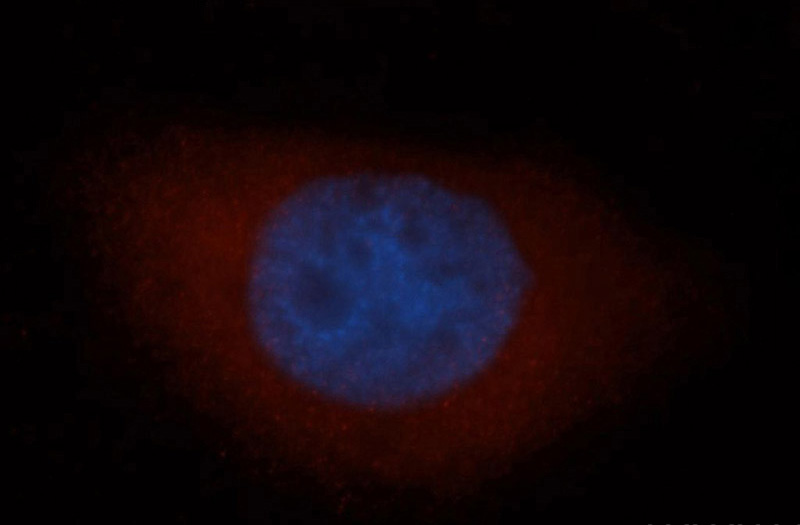 Immunofluorescent analysis of MCF-7 cells, using CAPG antibody Catalog No:108934 at 1:50 dilution and Rhodamine-labeled goat anti-rabbit IgG (red). Blue pseudocolor = DAPI (fluorescent DNA dye).