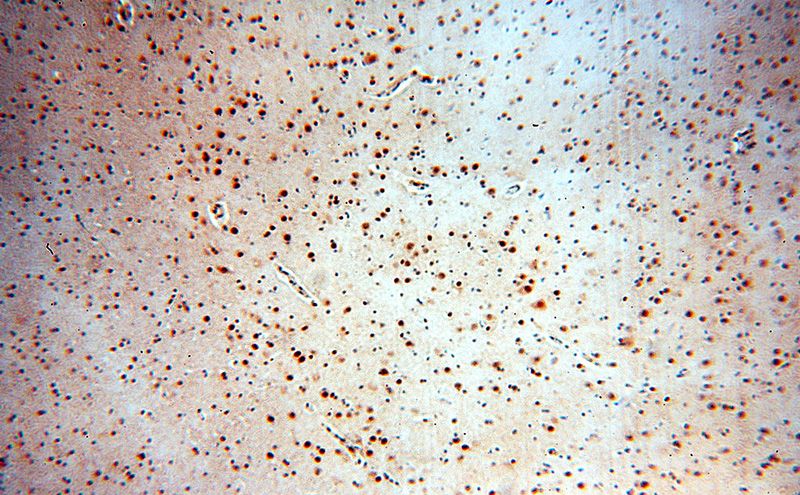 Immunohistochemical of paraffin-embedded human brain using Catalog No:115583(SRF antibody) at dilution of 1:50 (under 10x lens)