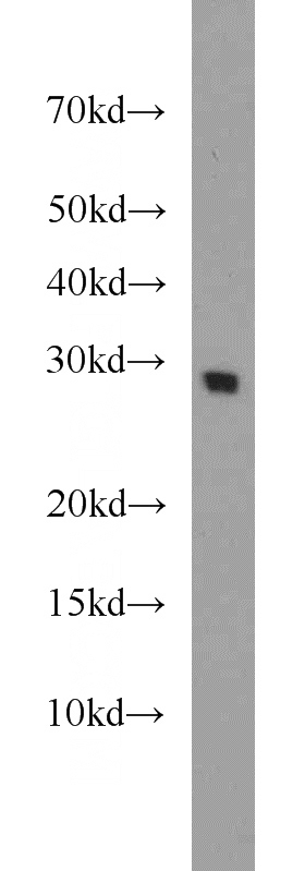 mouse skeletal muscle tissue were subjected to SDS PAGE followed by western blot with Catalog No:113777(PGAM2 antibody) at dilution of 1:1500