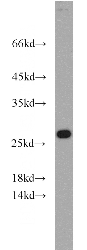 COLO 320 cells were subjected to SDS PAGE followed by western blot with Catalog No:114816(RPL15 antibody) at dilution of 1:300