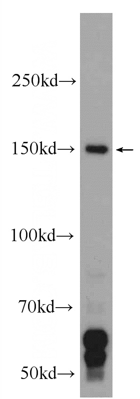 HEK-293 cells were subjected to SDS PAGE followed by western blot with Catalog No:112051(KIF7 Antibody) at dilution of 1:1000