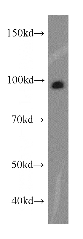 mouse ovary tissue were subjected to SDS PAGE followed by western blot with Catalog No:116612(UNC45A antibody) at dilution of 1:300