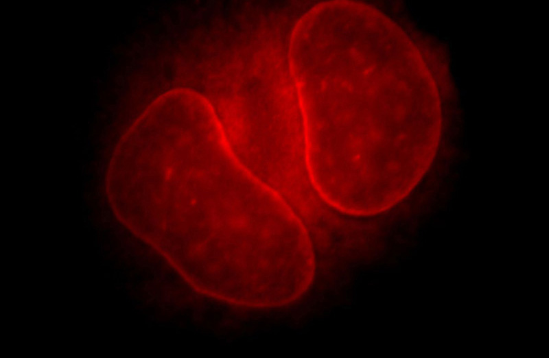 Immunofluorescent analysis of Hela cells, using THAP2 antibody Catalog No:116040 at 1:25 dilution and Rhodamine-labeled goat anti-rabbit IgG (red).