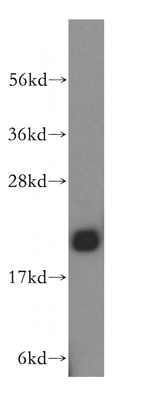 mouse liver tissue were subjected to SDS PAGE followed by western blot with Catalog No:113187(NIP7 antibody) at dilution of 1:500