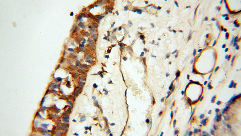 Immunohistochemical of paraffin-embedded human trachea using Catalog No:115937(TEKT2 antibody) at dilution of 1:50 (under 40x lens)