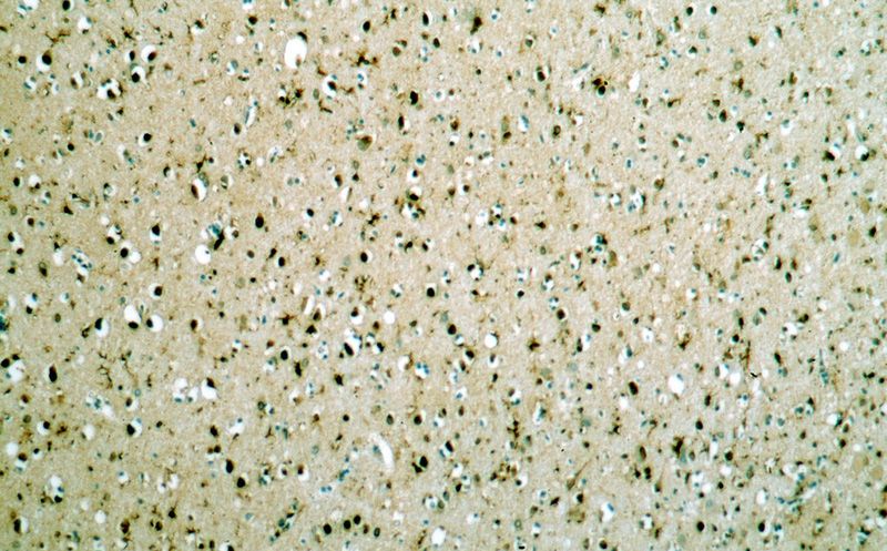 Immunohistochemical of paraffin-embedded human brain using Catalog No:115897(SII-TFIIS,TCEA1 antibody) at dilution of 1:400 (under 10x lens)