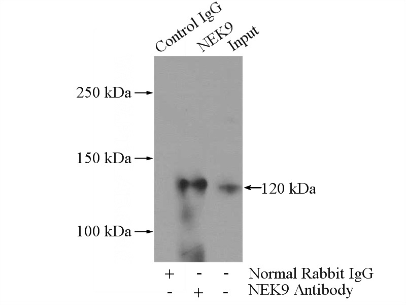 IP Result of anti-NEK9 (IP:Catalog No:113106, 5ug; Detection:Catalog No:113106 1:500) with HeLa cells lysate 2000ug.