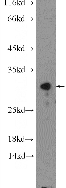 mouse liver tissue were subjected to SDS PAGE followed by western blot with Catalog No:109630(CWC15 Antibody) at dilution of 1:600