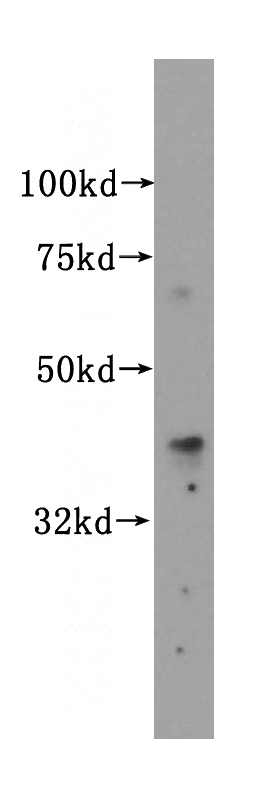BxPC-3 cells were subjected to SDS PAGE followed by western blot with Catalog No:111941(ISL1 antibody) at dilution of 1:500