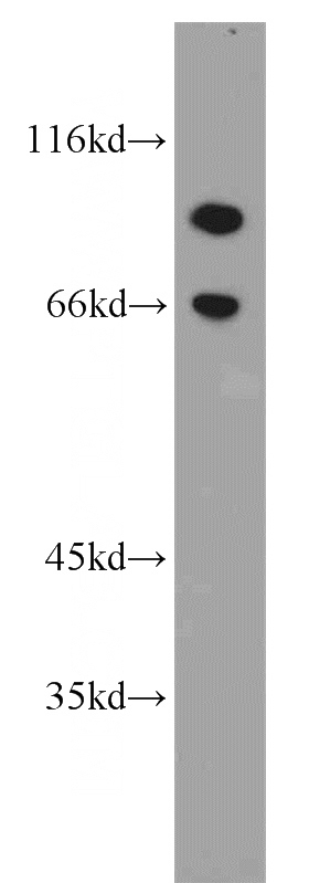 A549 cells were subjected to SDS PAGE followed by western blot with Catalog No:111411(HJURP antibody) at dilution of 1:800
