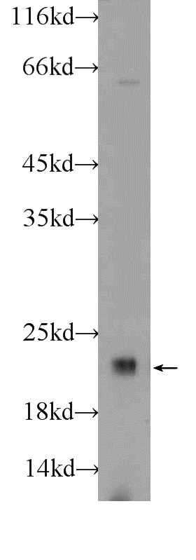 mouse brain tissue were subjected to SDS PAGE followed by western blot with Catalog No:109466(COPS8 Antibody) at dilution of 1:600