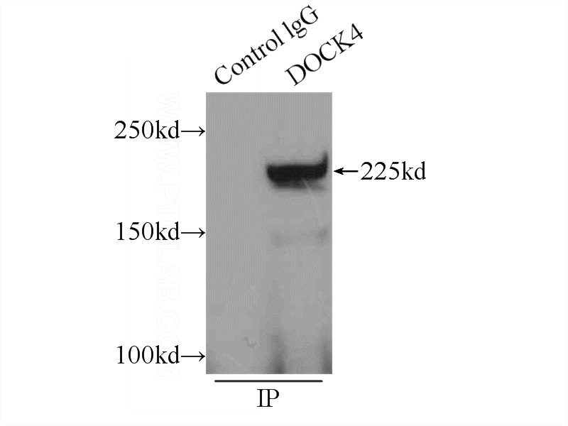 IP Result of anti-DocK4 (IP:Catalog No:110044, 5ug; Detection:Catalog No:110044 1:500) with HeLa cells lysate 1800ug.