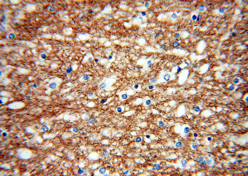 Immunohistochemical of paraffin-embedded human brain using Catalog No:113694(PCDHA3 antibody) at dilution of 1:50 (under 40x lens)
