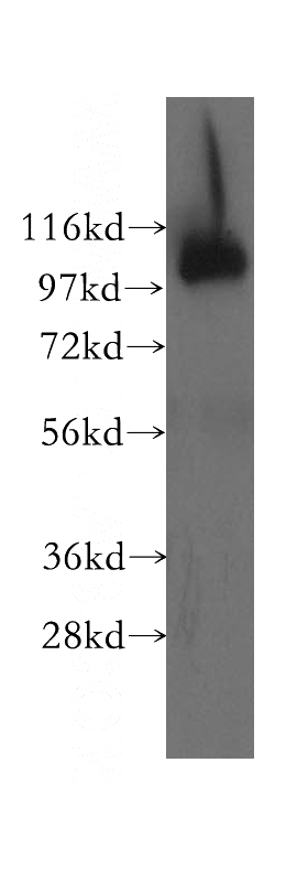 Y79 cells were subjected to SDS PAGE followed by western blot with Catalog No:113433(OSBPL3 antibody) at dilution of 1:400