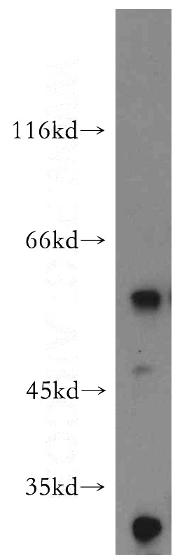 mouse colon tissue were subjected to SDS PAGE followed by western blot with Catalog No:108118(AP1M2 antibody) at dilution of 1:500