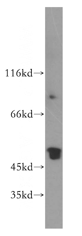 human brain tissue were subjected to SDS PAGE followed by western blot with Catalog No:114579(RCN2 antibody) at dilution of 1:400