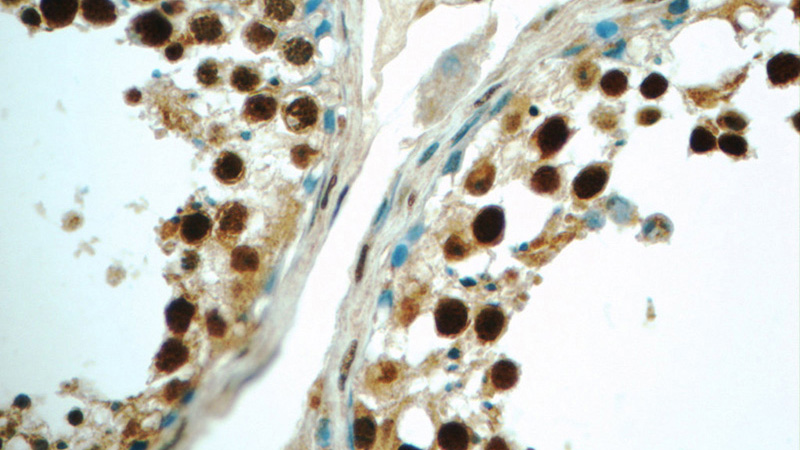 Immunohistochemistry of paraffin-embedded human testis tissue slide using Catalog No:111342(HIC1 Antibody) at dilution of 1:50 (under 40x lens)