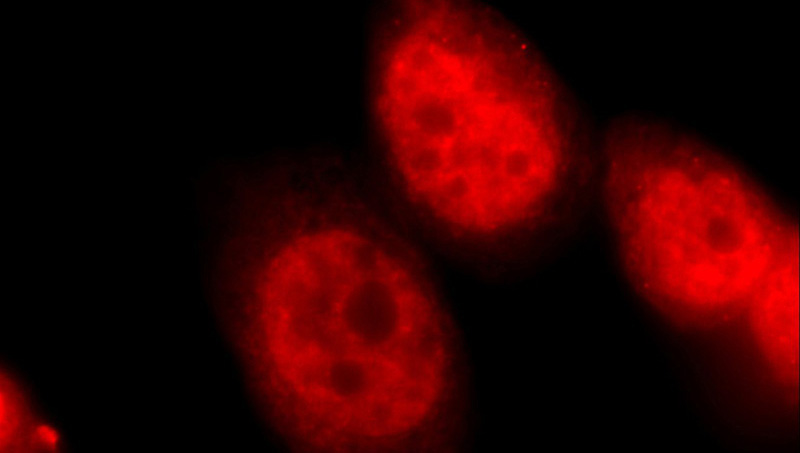 Immunofluorescent analysis of HeLa cells using Catalog No:113860(PK-M1-specific Antibody) at dilution of 1:50 and Rhodamine-Goat anti-Rabbit IgG