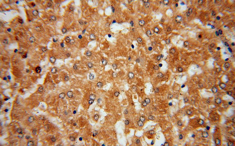 Immunohistochemical of paraffin-embedded human liver using Catalog No:109690(CYP27A1 antibody) at dilution of 1:50 (under 40x lens)