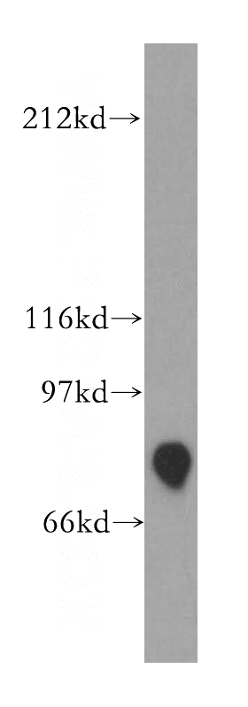 human kidney tissue were subjected to SDS PAGE followed by western blot with Catalog No:115148(SFRS17A antibody) at dilution of 1:400