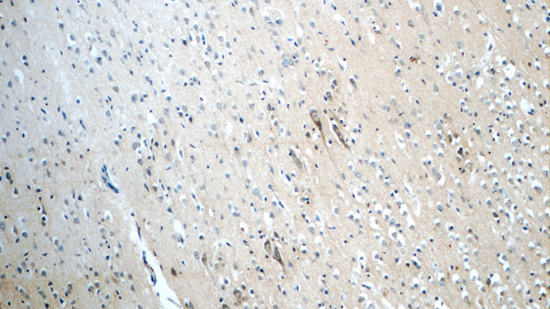 Immunohistochemistry of paraffin-embedded human brain slide using Catalog No:109302(SLC5A7 Antibody) at dilution of 1:50