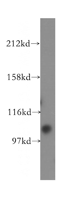 HEK-293 cells were subjected to SDS PAGE followed by western blot with Catalog No:116643(URG4 antibody) at dilution of 1:400