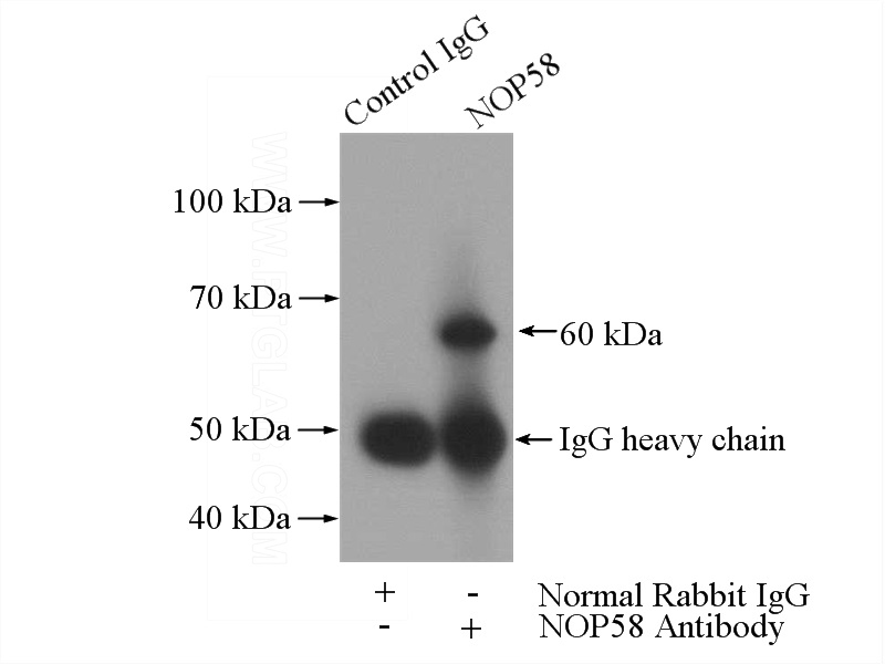 IP Result of anti-NOP58 (IP:Catalog No:113305, 4ug; Detection:Catalog No:113305 1:500) with K-562 cells lysate 3600ug.