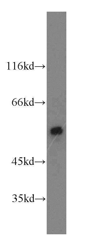 mouse brain tissue were subjected to SDS PAGE followed by western blot with Catalog No:108919(CAMK2D-Specific antibody) at dilution of 1:500