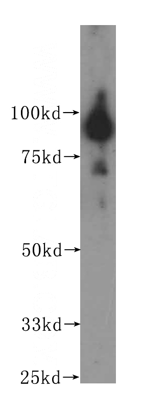 human brain tissue were subjected to SDS PAGE followed by western blot with Catalog No:117228(BRD3 antibody) at dilution of 1:200
