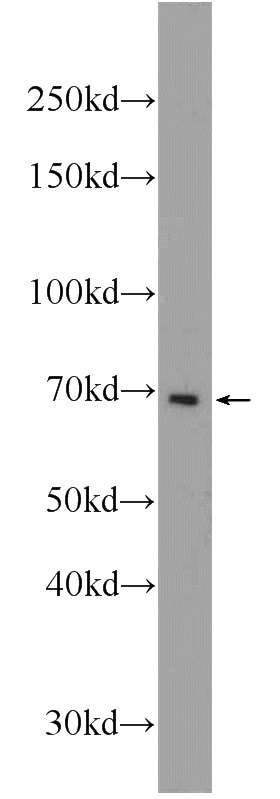 mouse spleen tissue were subjected to SDS PAGE followed by western blot with Catalog No:113753(PCSK7 Antibody) at dilution of 1:300
