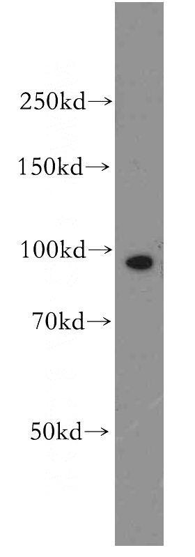 human brain tissue were subjected to SDS PAGE followed by western blot with Catalog No:108135(ANAPC4 antibody) at dilution of 1:500