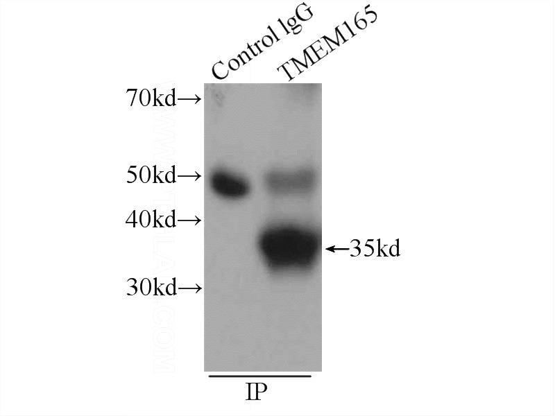 IP Result of anti-TMEM165 (IP:Catalog No:116102, 4ug; Detection:Catalog No:116102 1:1000) with HeLa cells lysate 3440ug.