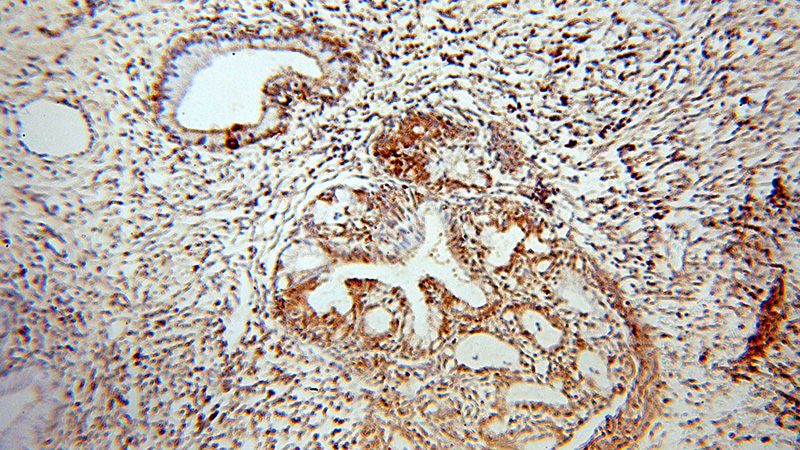 Immunohistochemical of paraffin-embedded human cervix using Catalog No:110903(GCHFR antibody) at dilution of 1:100 (under 10x lens)